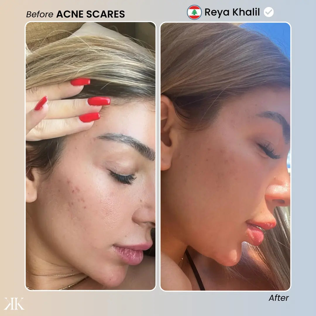 Kanz™ Instant Skin Glow LED Mask KANZ